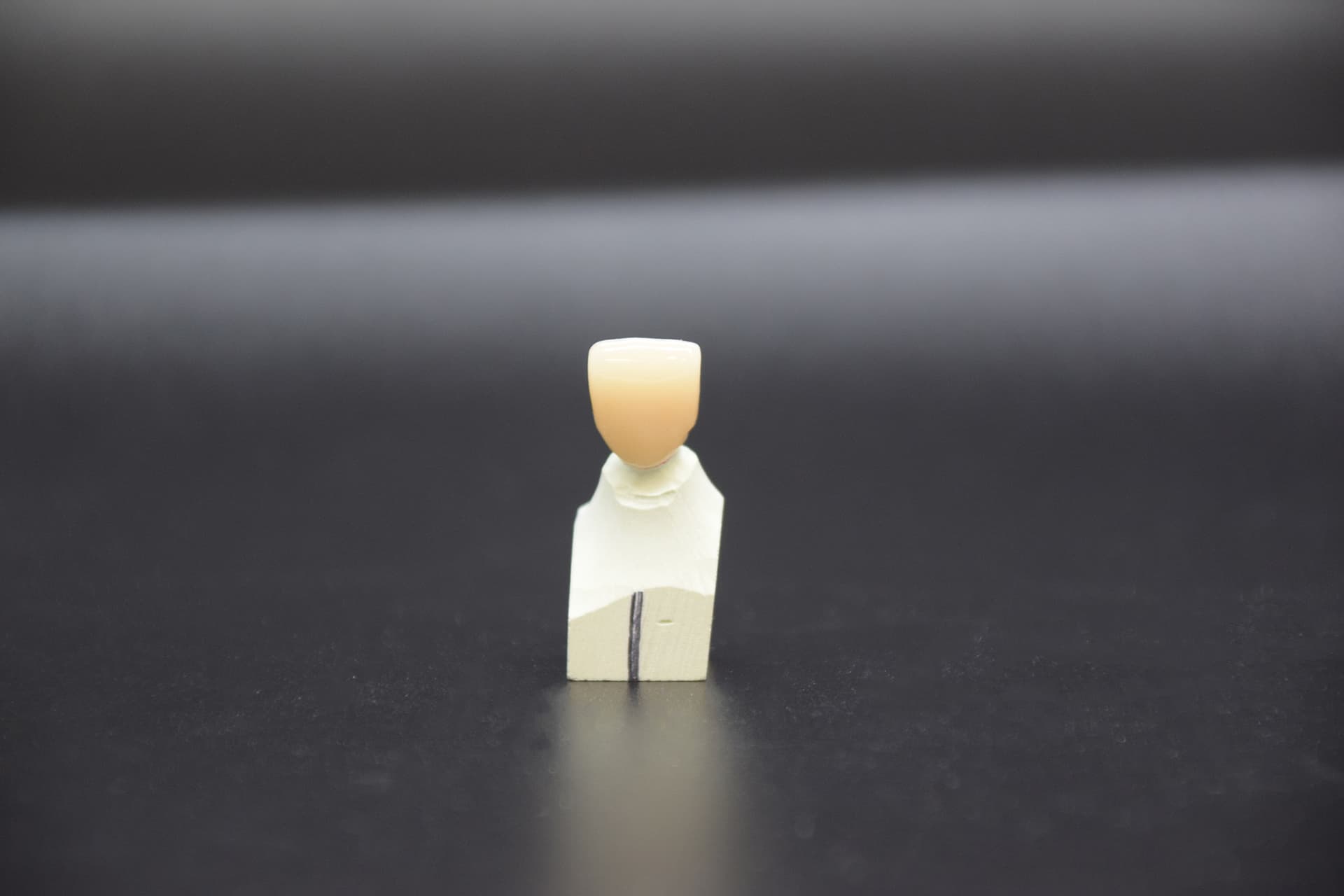 Zirconia dental crown on post -- the most popular crown type in Geneva clinics